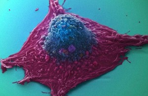 Kanker cel