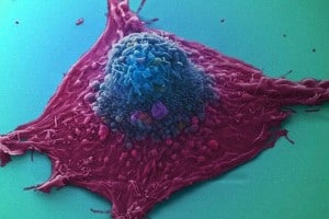 Kanker cel
