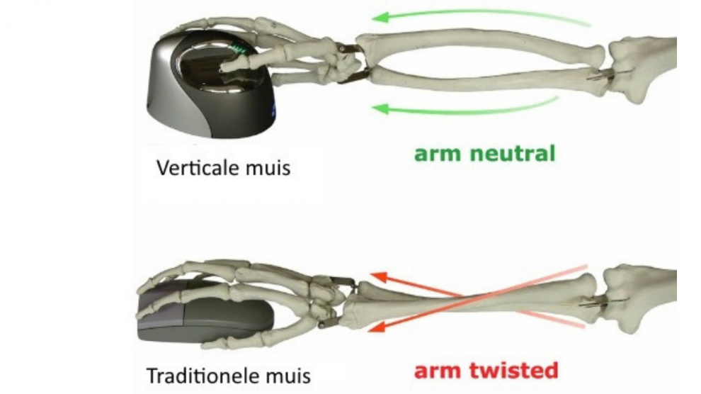 RSI klachten ergonomische muis