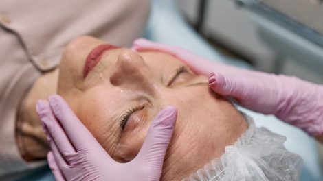Voordelen van een traangootbehandeling met fillers