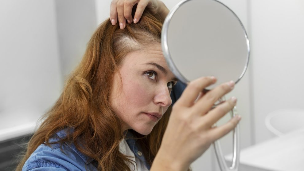 Grijze haren voorkomen - Deze invloed heeft voeding op grijze haren